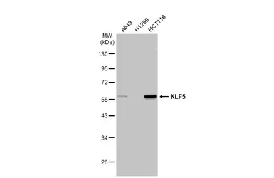 Anti-KLF5 antibody used in Western Blot (WB). GTX103289