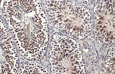 Anti-KLF5 antibody used in IHC (Paraffin sections) (IHC-P). GTX103289