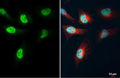 Anti-KLF5 antibody used in Immunocytochemistry/ Immunofluorescence (ICC/IF). GTX103289