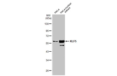 Anti-KLF5 antibody used in Western Blot (WB). GTX103289