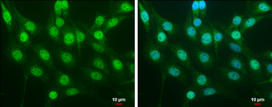 Anti-NRF2 antibody [N2C2], Internal used in Immunocytochemistry/ Immunofluorescence (ICC/IF). GTX103322