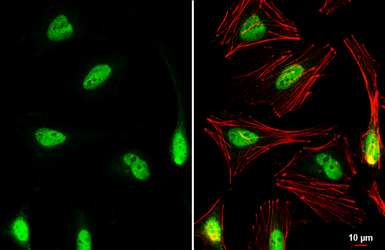 Anti-NRF2 antibody [N2C2], Internal used in Immunocytochemistry/ Immunofluorescence (ICC/IF). GTX103322