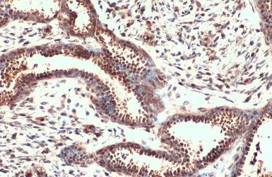 Anti-NRF2 antibody [N2C2], Internal used in IHC (Paraffin sections) (IHC-P). GTX103322