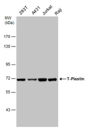 Anti-T-Plastin antibody used in Western Blot (WB). GTX103323