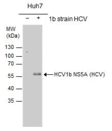 Anti-Hepatitis C virus NS5A protein antibody used in Western Blot (WB). GTX103358