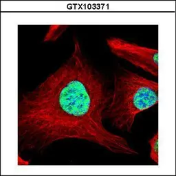 Anti-SART1 antibody [N2C1], Internal used in Immunocytochemistry/ Immunofluorescence (ICC/IF). GTX103371