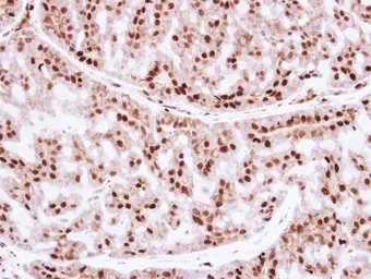 Anti-ZNF323 antibody [N1C3] used in IHC (Paraffin sections) (IHC-P). GTX103378