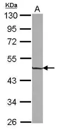 Anti-ZNF323 antibody [N1C3] used in Western Blot (WB). GTX103378