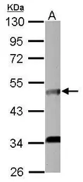 Anti-IL5 Receptor alpha antibody [N1C2] used in Western Blot (WB). GTX103418