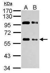 Anti-c-Myc antibody used in Western Blot (WB). GTX103436