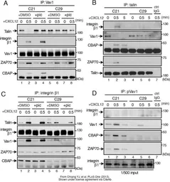 Anti-VAV1 antibody used in Western Blot and Immunoprecipitation (WB IP). GTX103489