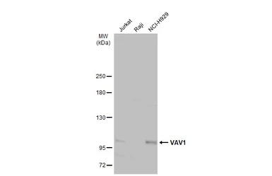 Anti-VAV1 antibody used in Western Blot (WB). GTX103489