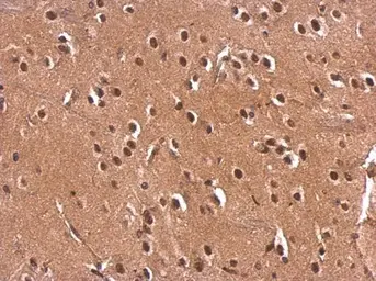 Anti-Monoglyceride lipase antibody used in IHC (Paraffin sections) (IHC-P). GTX103517