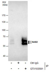 Anti-NAB2 antibody used in Immunoprecipitation (IP). GTX103581