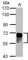 Anti-NAB2 antibody used in Western Blot (WB). GTX103581