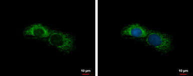 Anti-ALDH7A1 antibody used in Immunocytochemistry/ Immunofluorescence (ICC/IF). GTX103593