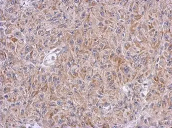 Anti-ALDH7A1 antibody used in IHC (Paraffin sections) (IHC-P). GTX103593