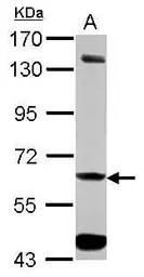 Anti-ALDH7A1 antibody used in Western Blot (WB). GTX103593