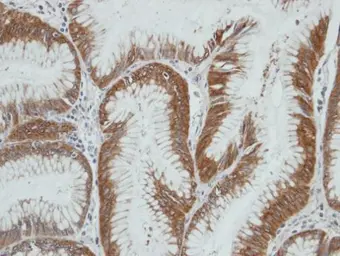 Anti-HSD3a antibody [N1C2] used in IHC (Paraffin sections) (IHC-P). GTX103613