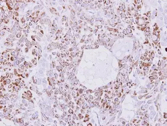 Anti-Creatine kinase MT antibody used in IHC (Paraffin sections) (IHC-P). GTX103627