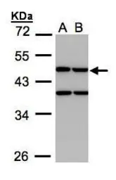 Anti-Creatine kinase MT antibody used in Western Blot (WB). GTX103627