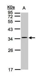 Anti-Cav gamma 5 antibody used in Western Blot (WB). GTX103664