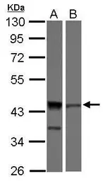 Anti-ICAD antibody [N1C3] used in Western Blot (WB). GTX103668