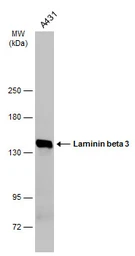 Anti-Laminin beta 3 antibody [C1C2], Internal used in Western Blot (WB). GTX103736