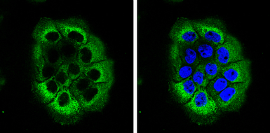 Anti-Laminin beta 3 antibody [C1C2], Internal used in Immunocytochemistry/ Immunofluorescence (ICC/IF). GTX103736