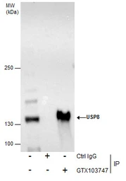 Anti-USP8 antibody used in Immunoprecipitation (IP). GTX103747