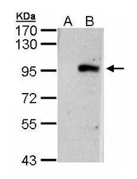 Anti-ECEL1 antibody [N3C2], Internal used in Western Blot (WB). GTX103771