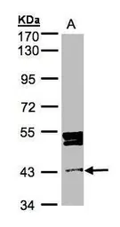 Anti-DDI1 antibody [N1C3] used in Western Blot (WB). GTX103772