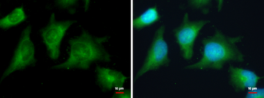 Anti-PKA R2 antibody used in Immunocytochemistry/ Immunofluorescence (ICC/IF). GTX103780