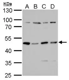 Anti-PKA R2 antibody used in Western Blot (WB). GTX103780