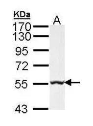 Anti-GLYCTK antibody [N2C3] used in Western Blot (WB). GTX103789