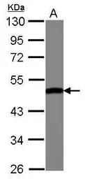 Anti-ENO3 antibody used in Western Blot (WB). GTX103808