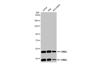 Anti-GNAL antibody used in Western Blot (WB). GTX103863