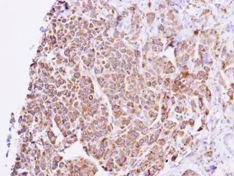 Anti-GNAL antibody used in IHC (Paraffin sections) (IHC-P). GTX103863