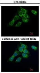 Anti-HSD17B4 antibody used in Immunocytochemistry/ Immunofluorescence (ICC/IF). GTX103864