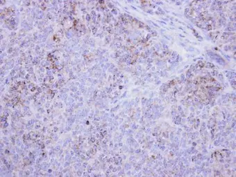 Anti-HSD17B4 antibody used in IHC (Paraffin sections) (IHC-P). GTX103864