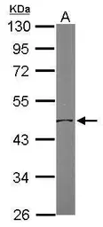 Anti-OAT antibody [N1C3] used in Western Blot (WB). GTX103893