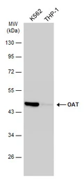 Anti-OAT antibody [N1C3] used in Western Blot (WB). GTX103893