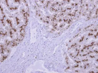 Anti-TPP1 antibody used in IHC (Paraffin sections) (IHC-P). GTX103896