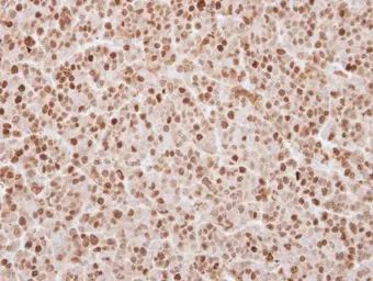Anti-UHRF1 antibody used in IHC (Paraffin sections) (IHC-P). GTX103925