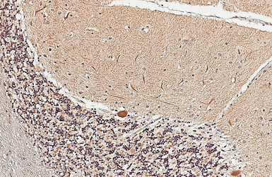 Anti-ST3GAL2 antibody [N2C3] used in IHC (Paraffin sections) (IHC-P). GTX103942