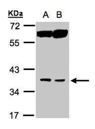 Anti-ACOT8 antibody [N1C3] used in Western Blot (WB). GTX103960