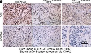 Anti-CDK6 antibody [N1C3] used in IHC (Paraffin sections) (IHC-P). GTX103992