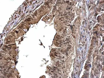 Anti-CDK6 antibody [N1C3] used in IHC (Paraffin sections) (IHC-P). GTX103992