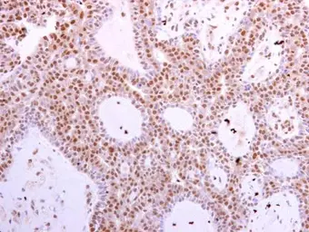 Anti-CDK6 antibody [N1C3] used in IHC (Paraffin sections) (IHC-P). GTX103992