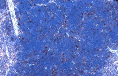 Anti-CDK6 antibody [N1C3] used in IHC (Paraffin sections) (IHC-P). GTX103992